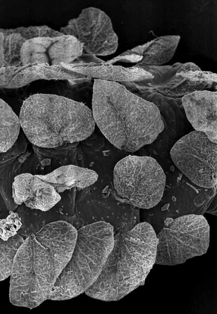            Fig. 3.   Phyllotetranychus aegyptium  adult   female dorsal setae (image: Gary Bauchan, USDA-ARS).   