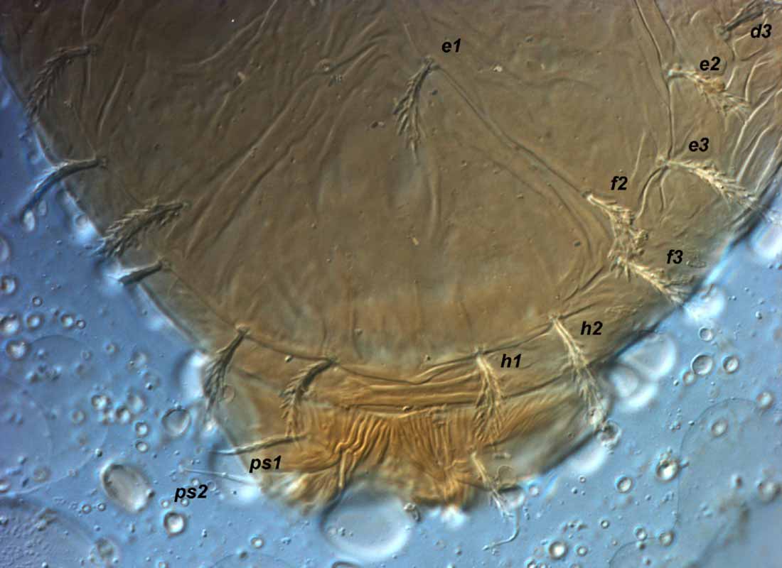            Fig. 2.   Phytoptipalpus conostegiae  female   posterior dorsum (type).   