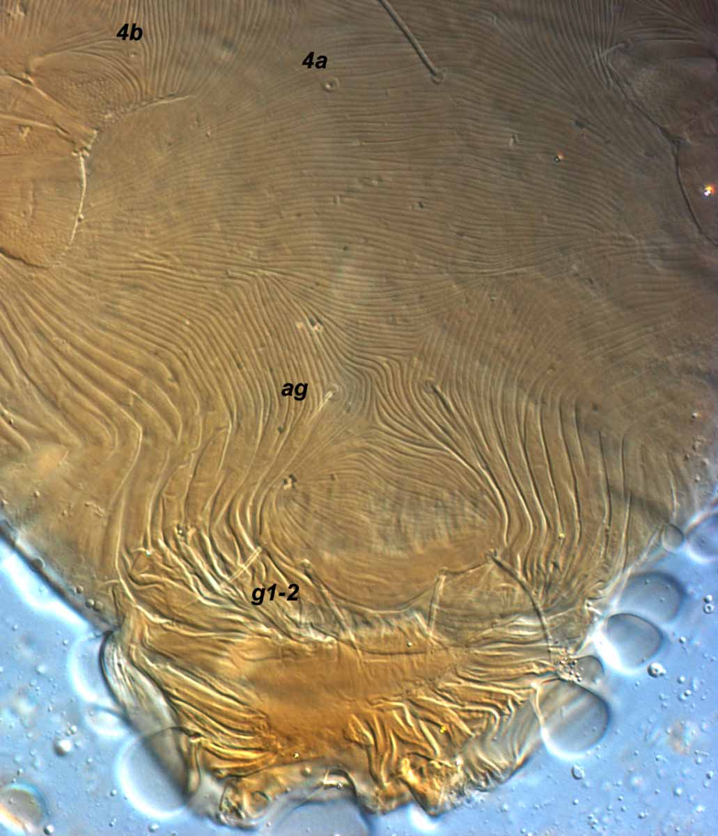           Fig. 4.   Phytoptipalpus conostegiae  female   posterior venter.    