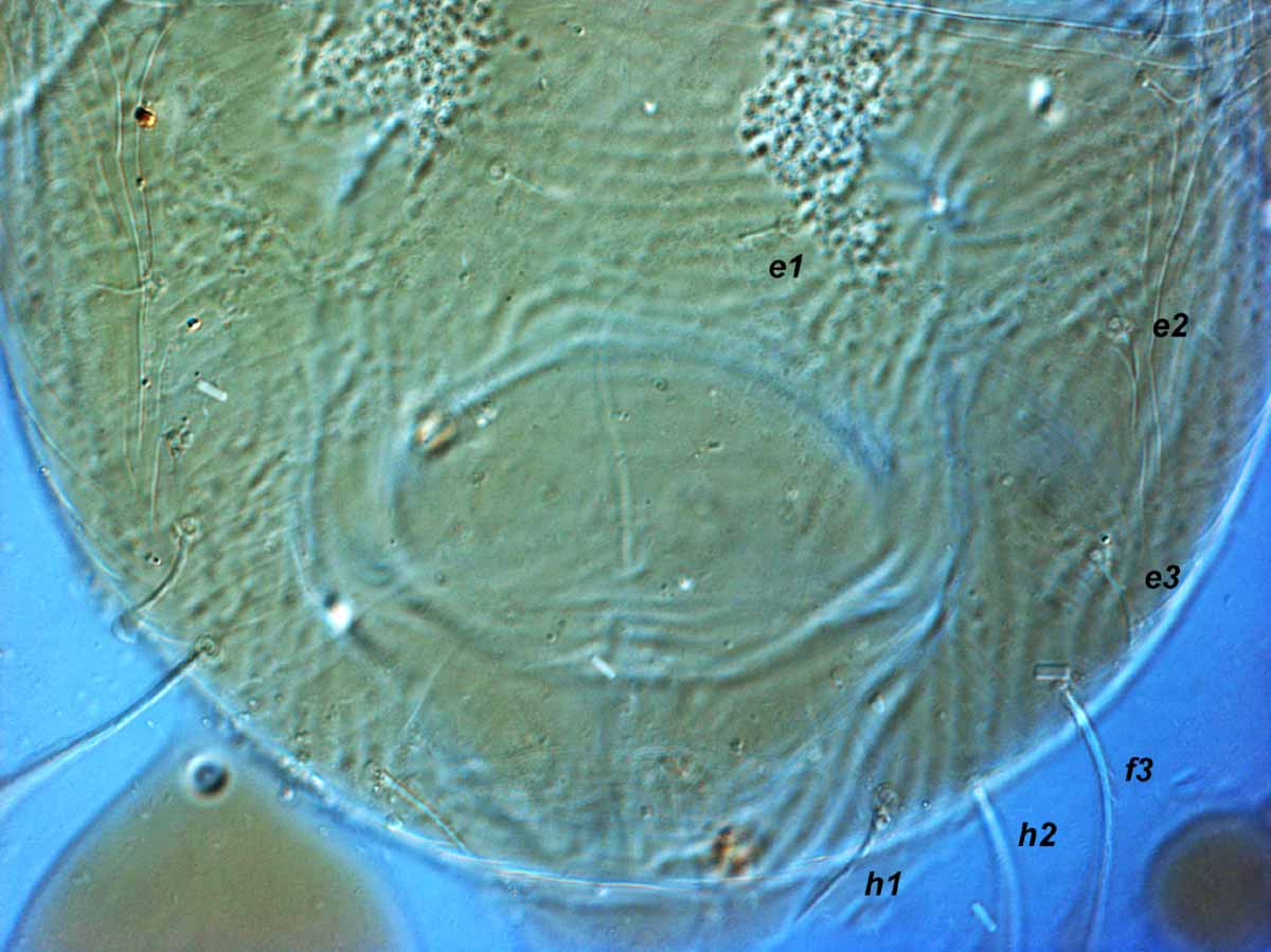           Fig. 4.   Pseudoleptus arechavaletae  female   posterior dorsum (type).    