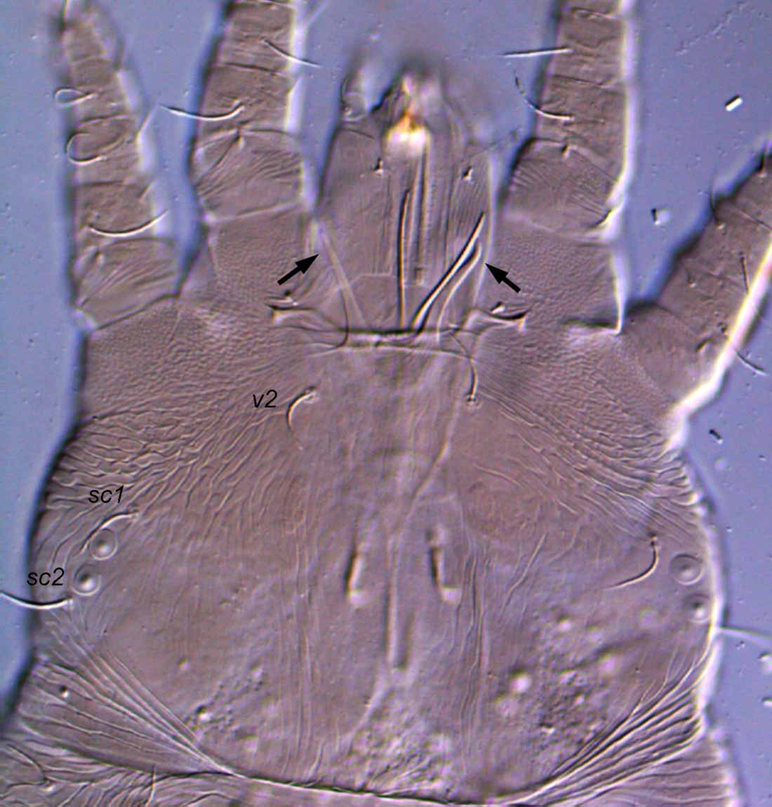            Fig. 7.   Pseudoleptus  sp. female anterior   prodorsum.   