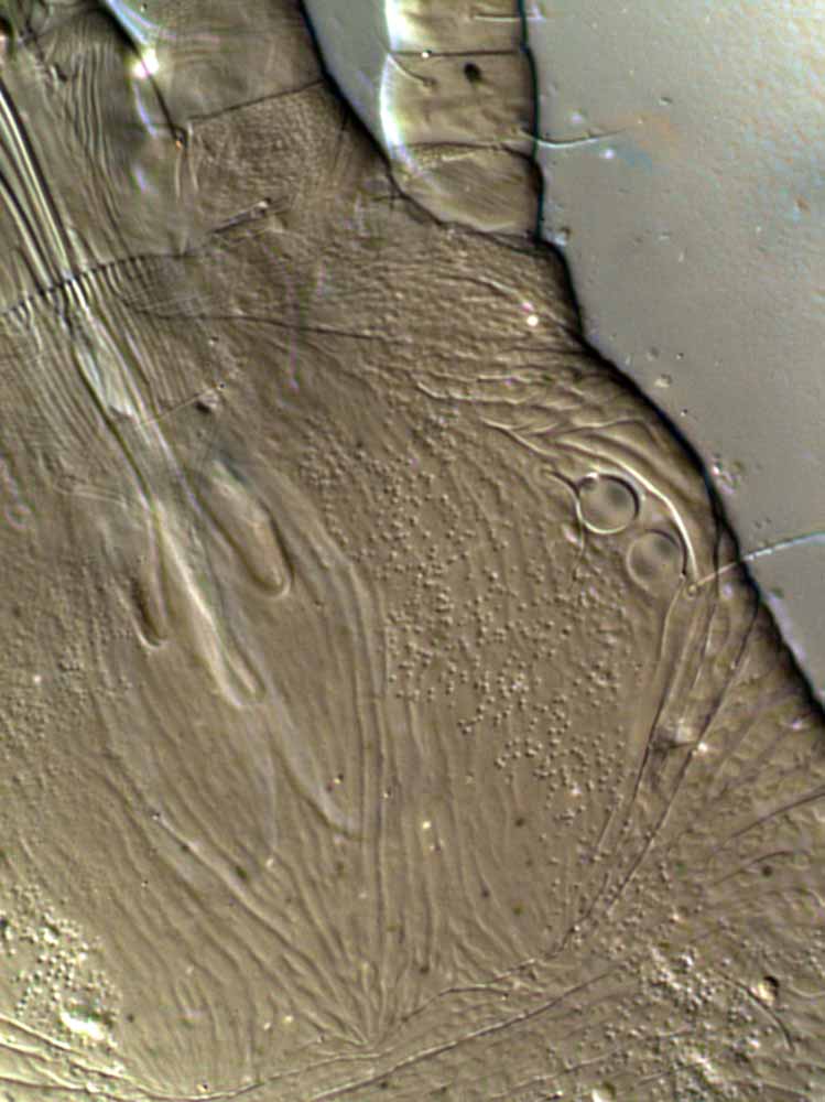            Fig. 17.   Pseudoleptus tridens  female   prodorsum, detail of cuticular pattern (type).   