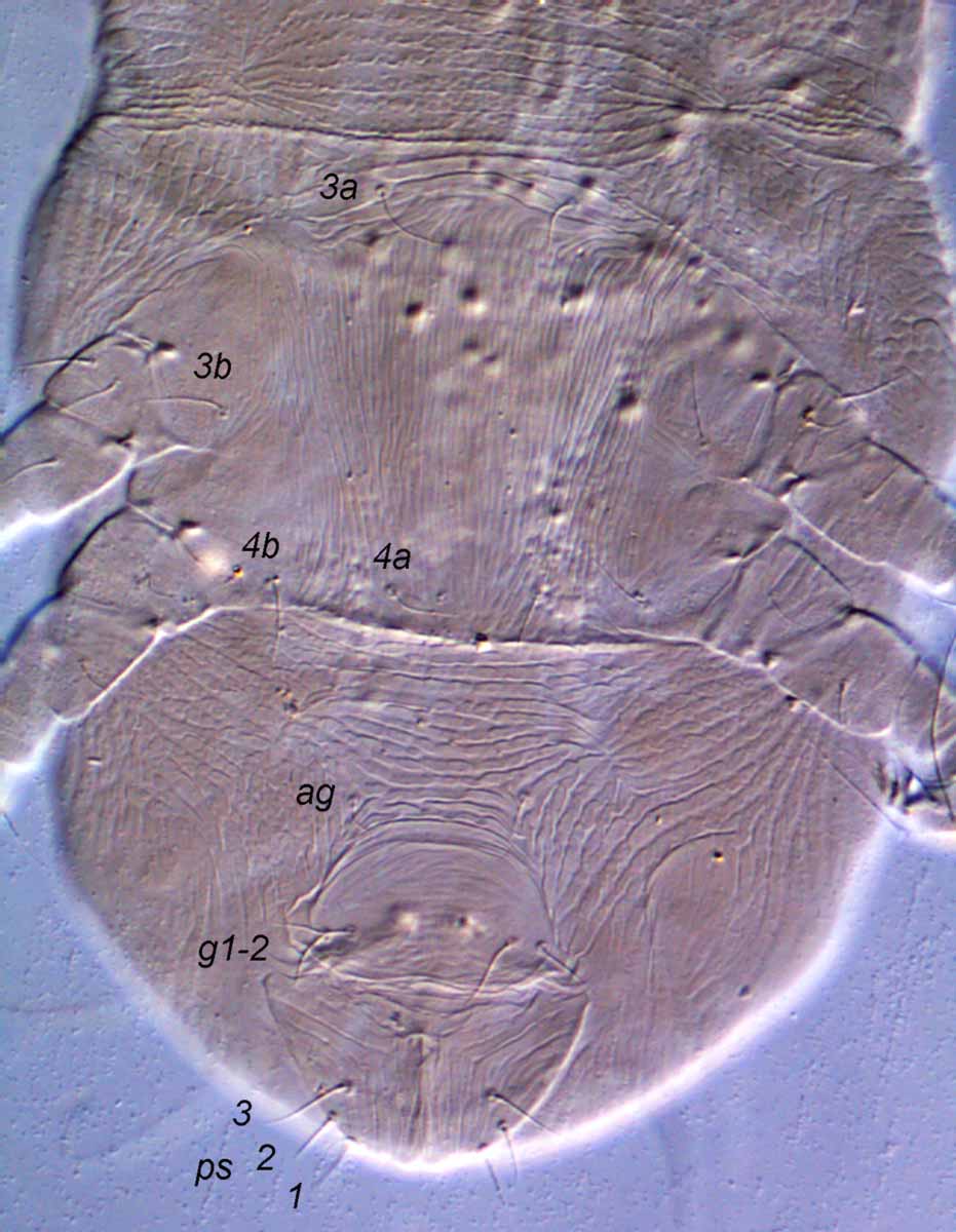            Fig. 11.   Pseudoleptus  sp. female venter.      