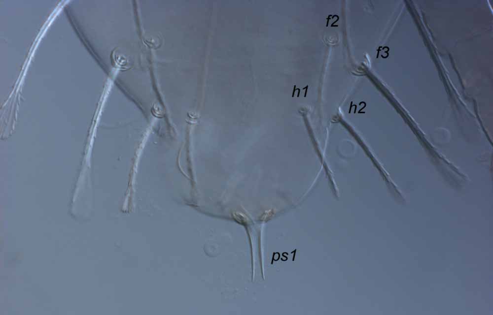  Fig. 9.  Raoiella goyderi nbsp;adult male posterior dorsum (indicating  ps1  setae). 
