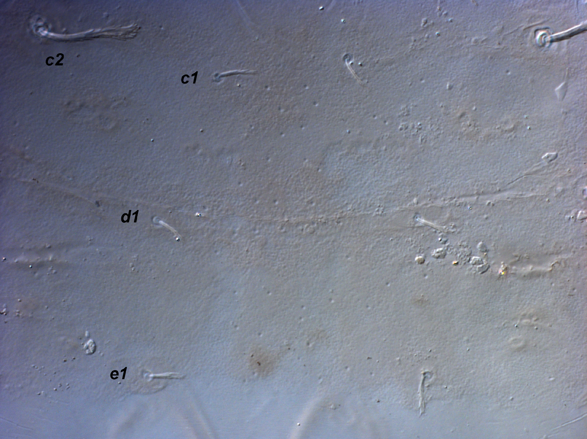            Fig. 3.   Raoiella australica  adult female,   central dorsum.   