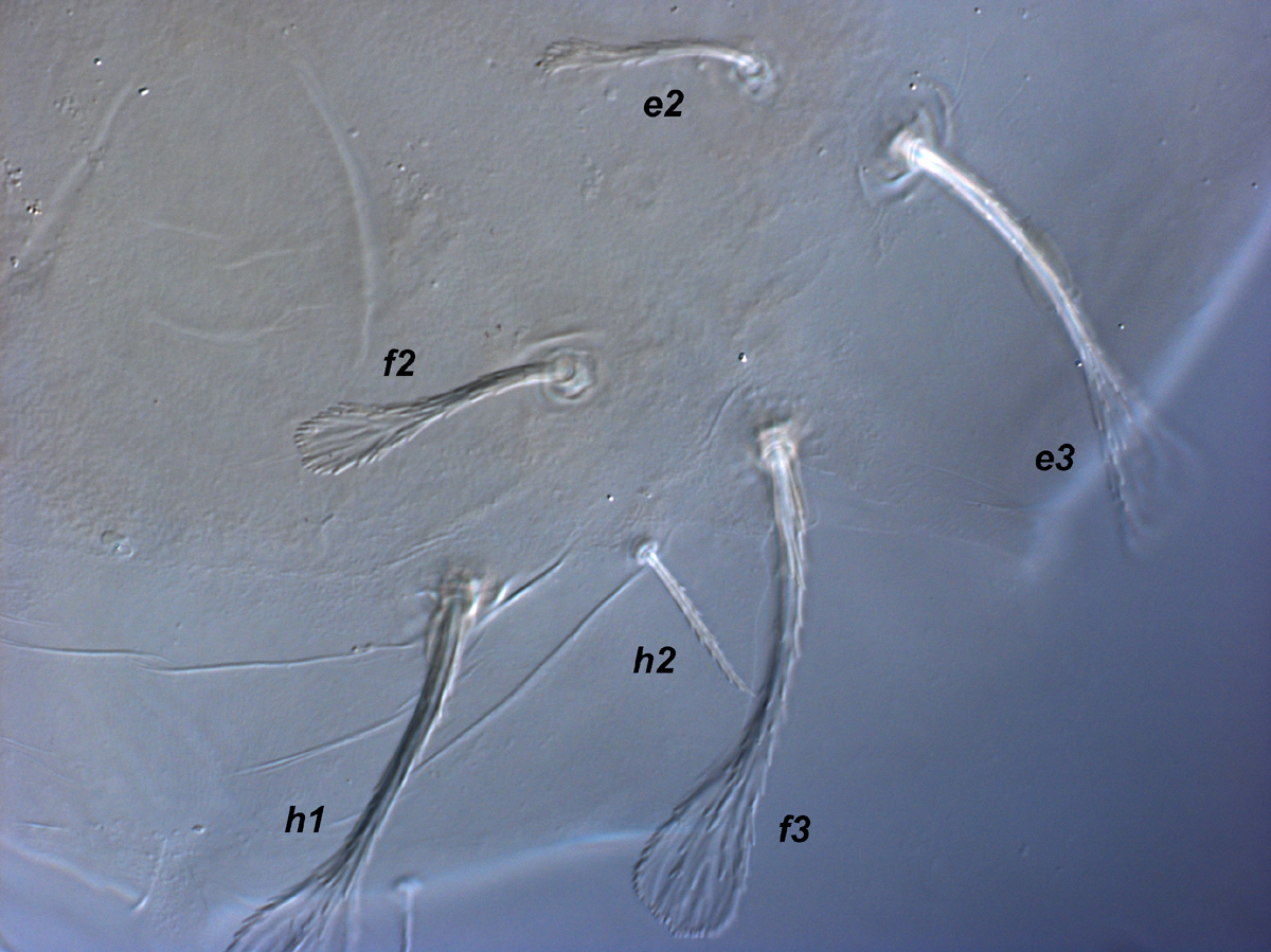            Fig. 4.   Raoiella australica  adult female, posterior   dorsum.   
