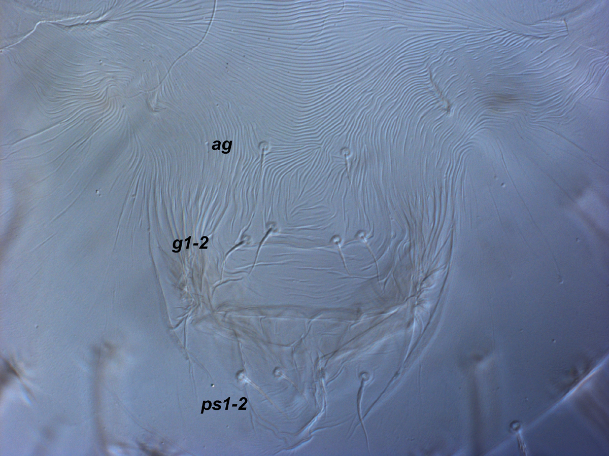            Fig. 11.   Raoiella australica  adult female posterior   venter.   