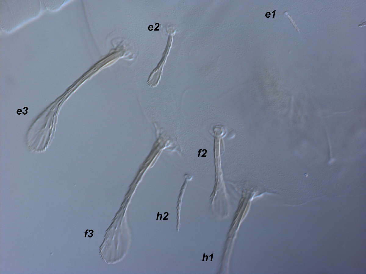            Fig. 5.   Raoiella australica  adult female, posterior   dorsum.   