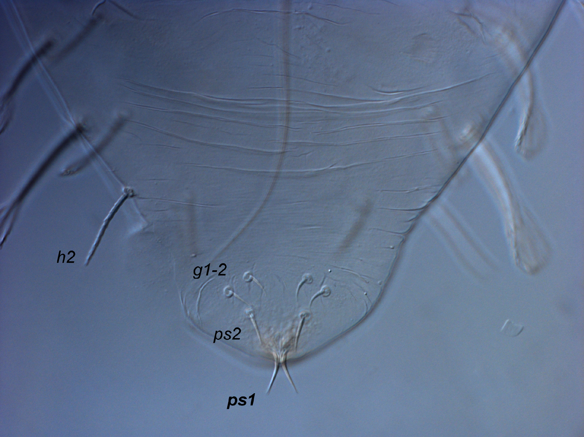            Fig. 12.   Raoiella australica  adult male, posterior venter   (indicating modified  ps1  setae).   