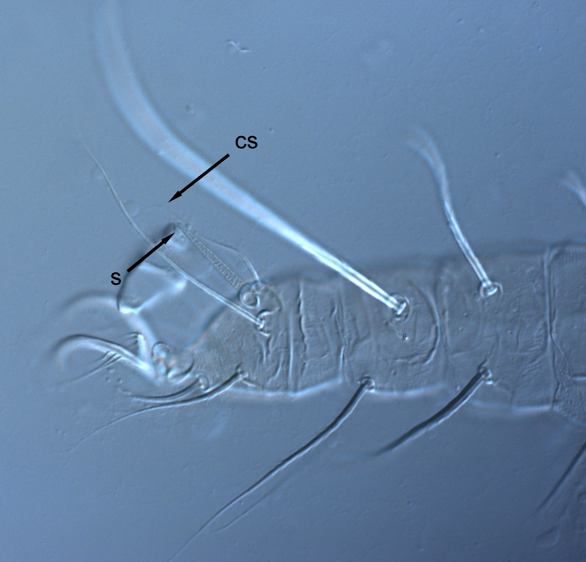  Fig. 6.  Raoiella calgoa nbsp;adult female leg with companion seta (cs) longer than solenidion (s). 
