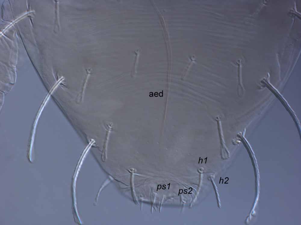  Fig. 11.  Raoiella wandoo nbsp;adult male posterior dorsum indicating setae  ps1 . 
