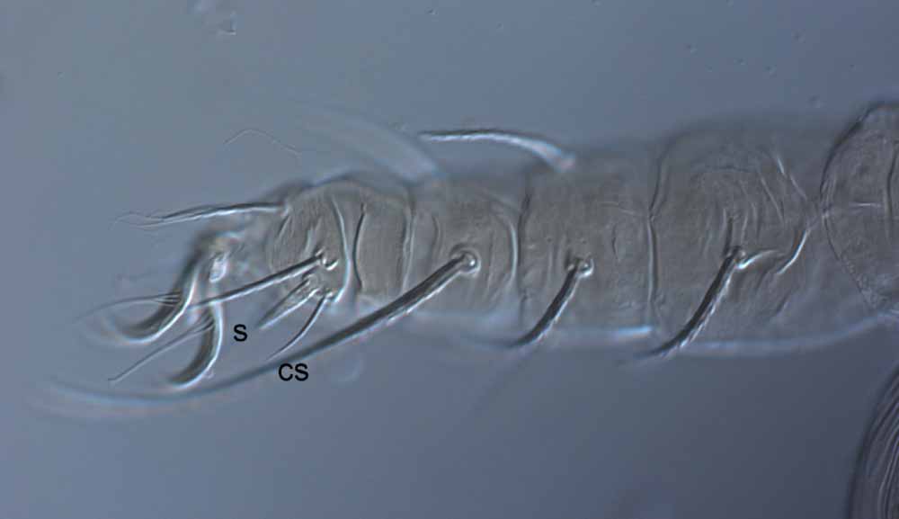  Fig. 6.  Raoiella wandoo nbsp;adult female leg II (s = solenidion; cs = companion seta). 
