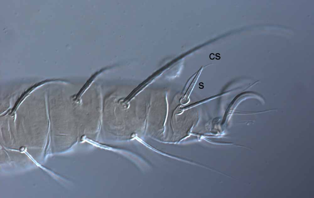  Fig. 5.  Raoiella wandoo nbsp;adult female leg I (s = solenidion; cs = companion seta). 
