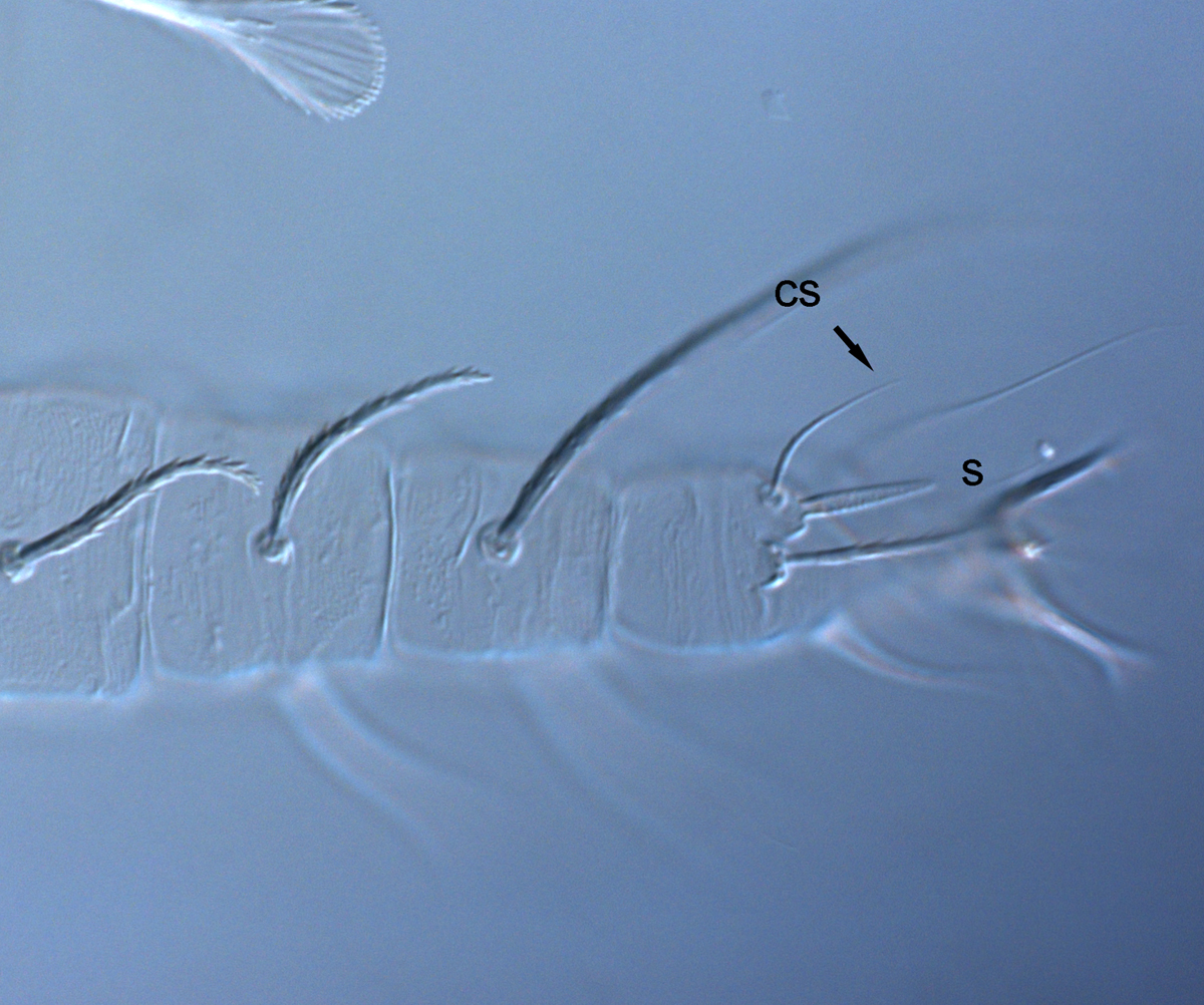  Fig. 7.  Raoiella todtiana nbsp;adult female leg II (s = solenidion, cs = companion seta). 
