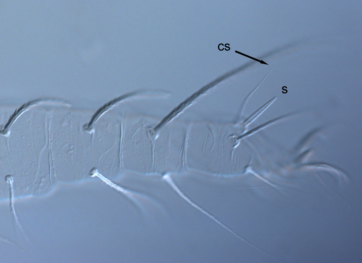  Fig. 6.  Raoiella todtiana nbsp;adult female leg I (s = solenidion, cs = companion seta). 
