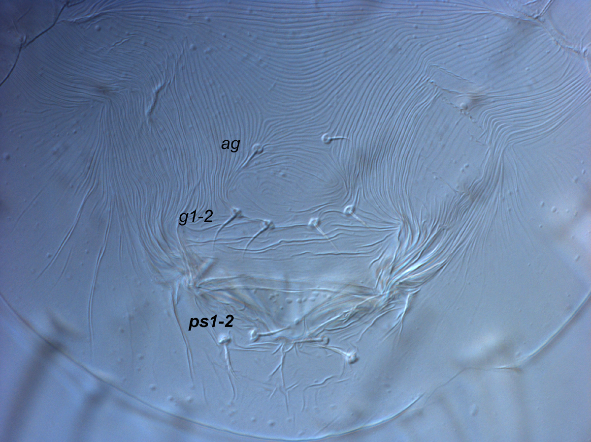  Fig. 11.  Raoiella todtiana nbsp;adult female posterior venter (genital region). 
