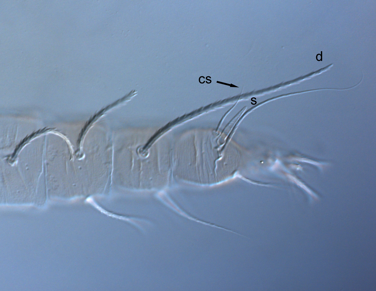  Fig. 8.  Raoiella todtiana nbsp;adult female leg II (s = solenidion, cs = companion seta). 

