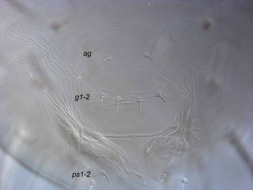  Fig. 7.  Raoiella tallerack  female posterior venter indicating setae  ps1-2 . 
