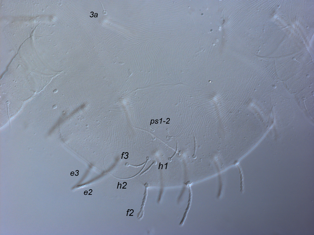  Fig. 9.  Raoiella tallerack nbsp;larva, posterior venter, indicating elongate filiform setae  h2 . 
