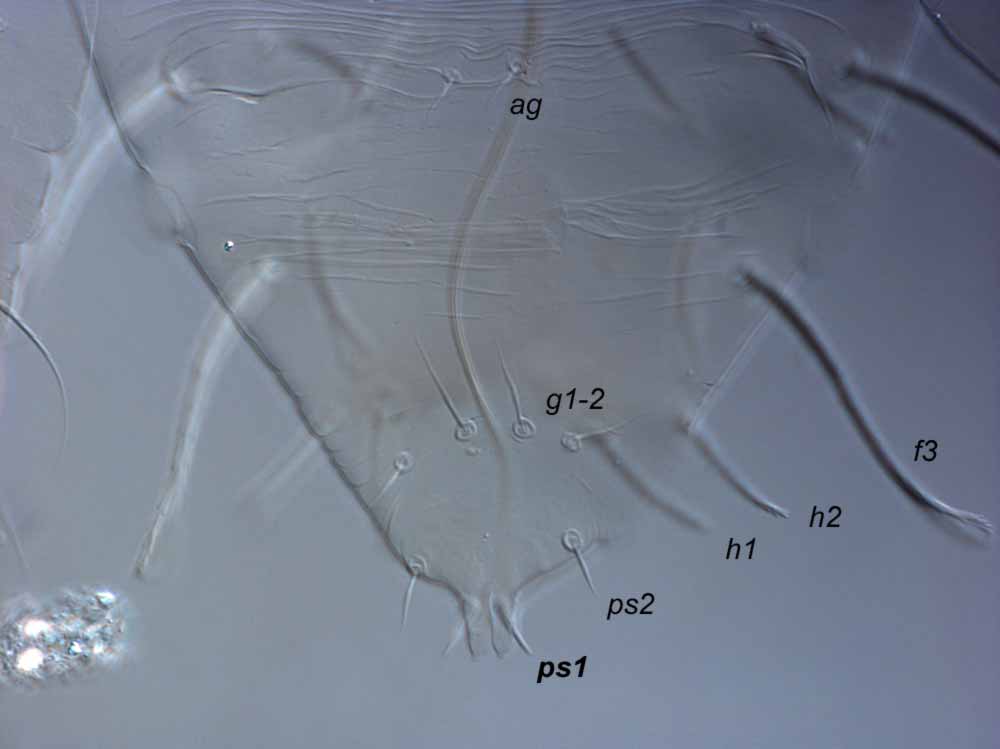  Fig. 8.  Raoiella tallerack nbsp;male posterior venter indicating  ps1  setae. 
