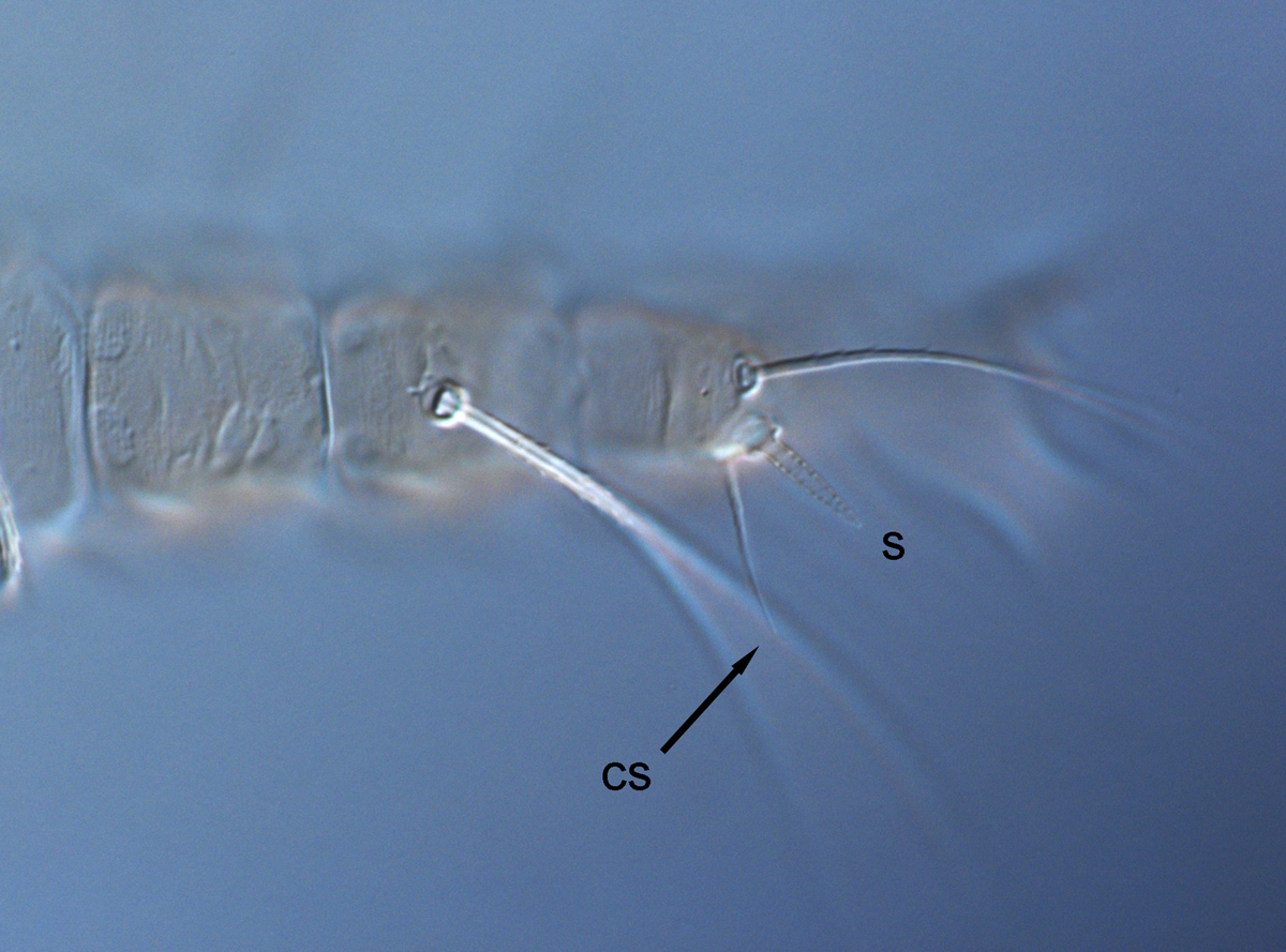  Fig. 7.  Raoiella marri nbsp;adult female leg I with companion seta (cs) longer than solenidion (s). 
