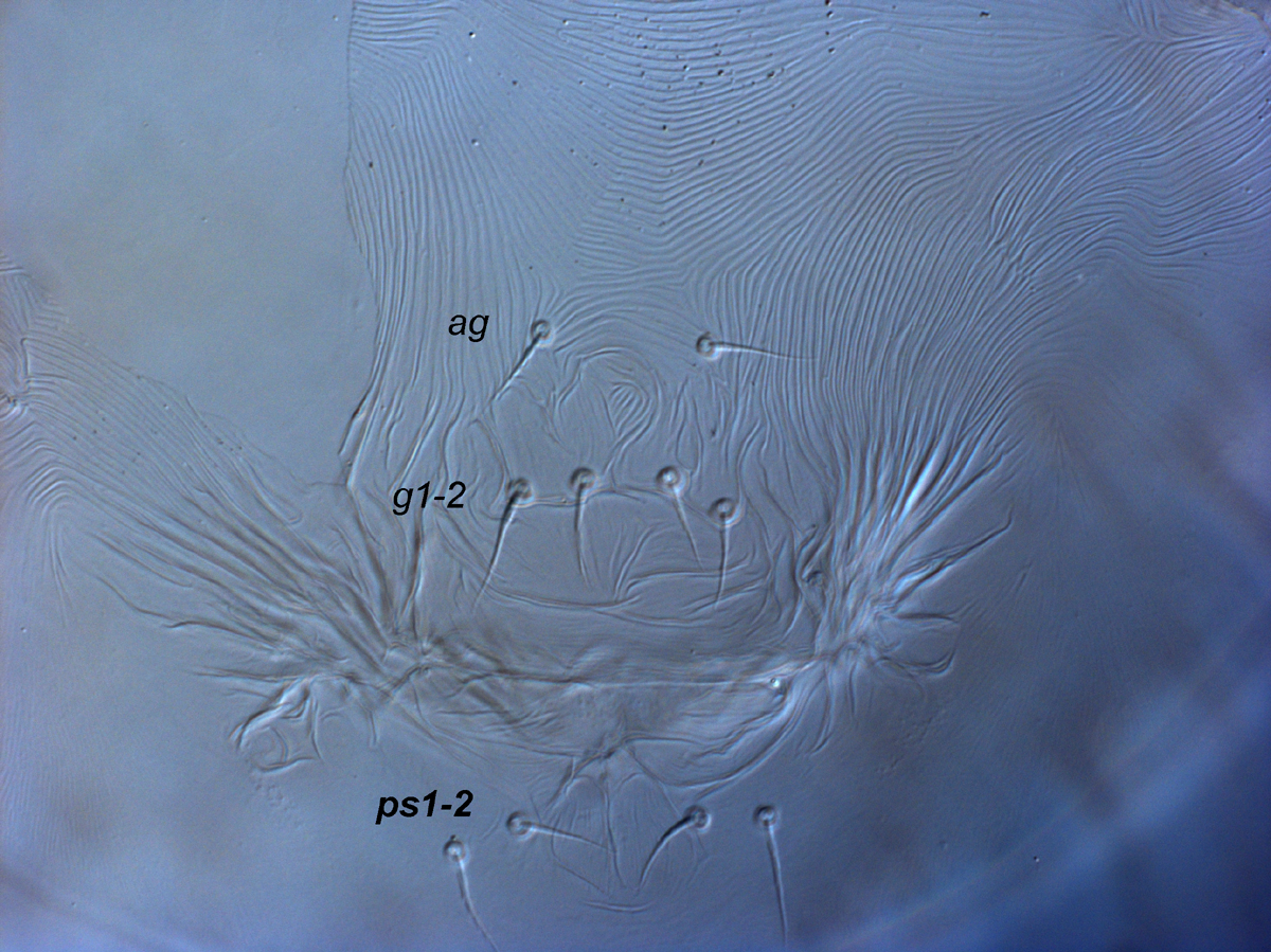 Fig. 12.  Raoiella marri nbsp;adult female posterior venter (genital region). 
