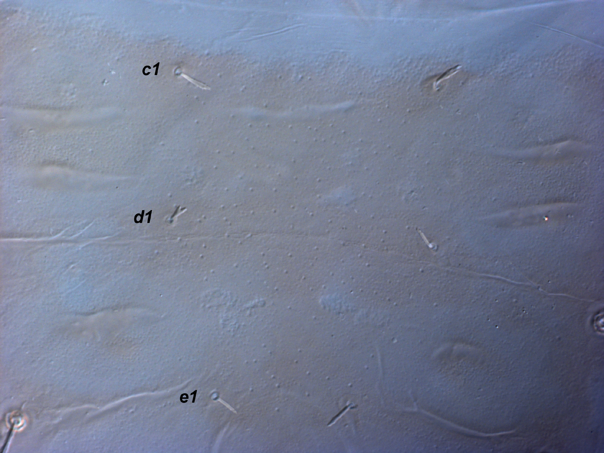 Fig. 3.  Raoiella marri nbsp;adult female central dorsum. 
