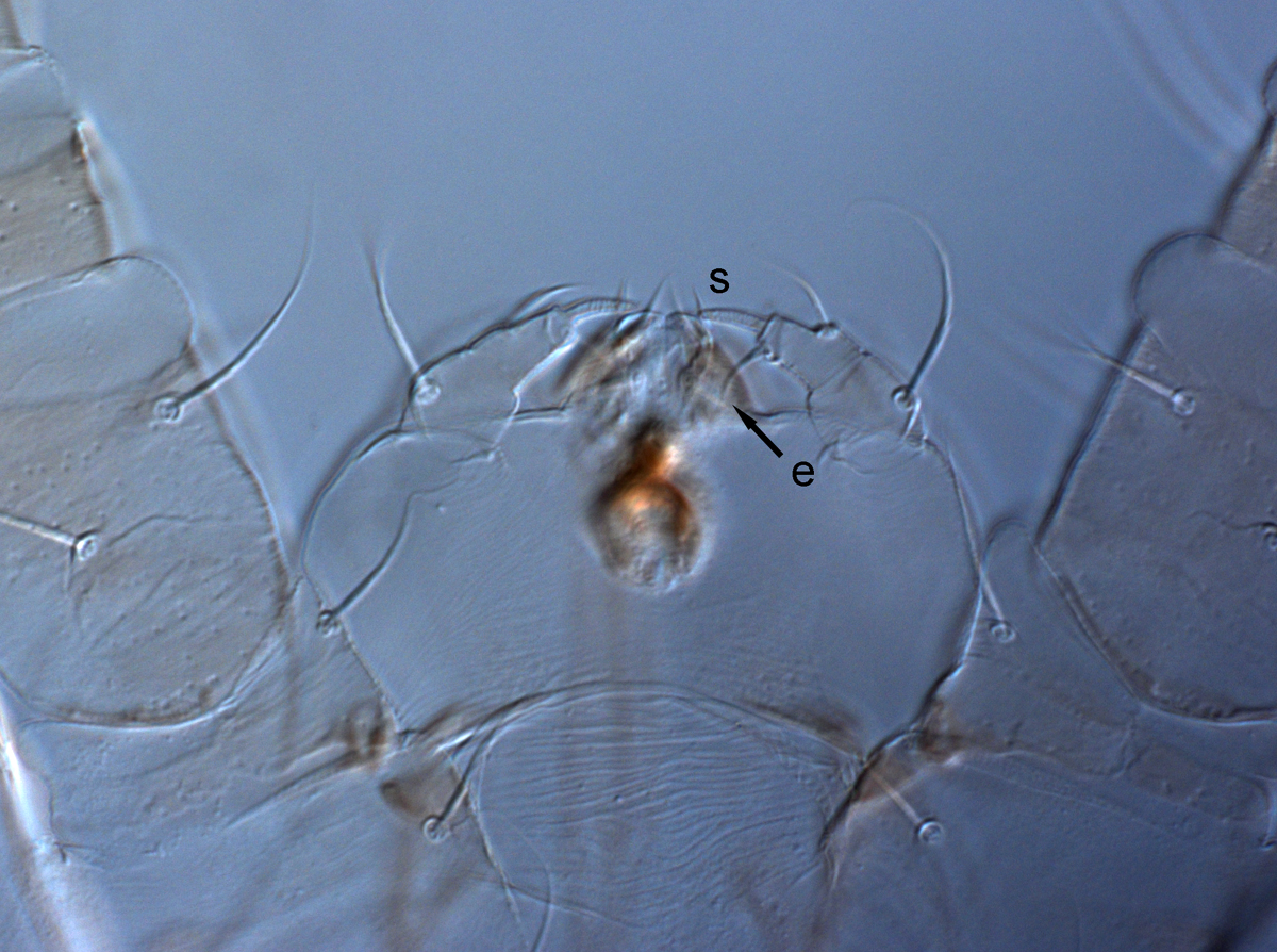  Fig. 11.  Raoiella marri nbsp;adult female palps (s = solenidion, e = eupathidium). 
