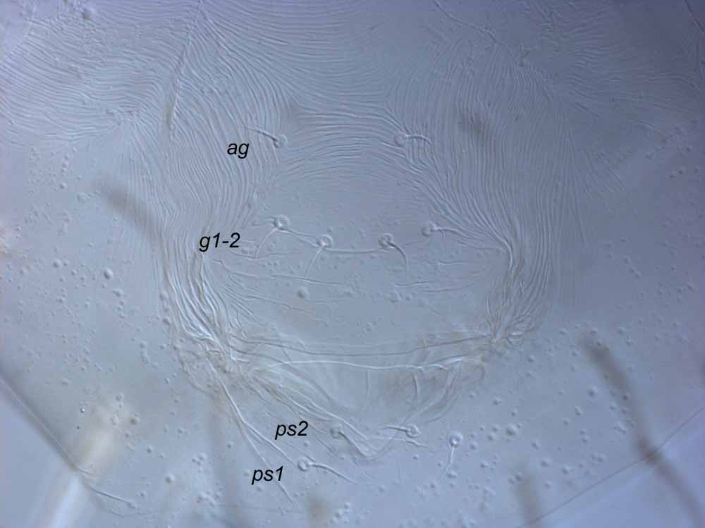  Fig. 7.  Raoiella karri nbsp;female posterior venter. 
