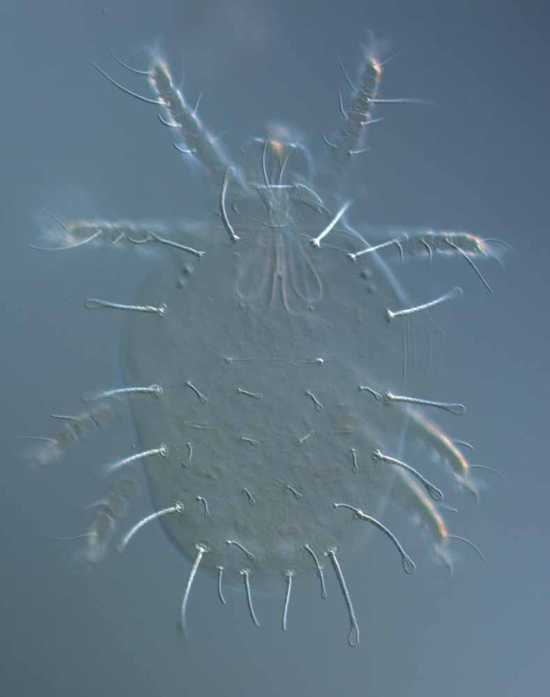  Fig. 1.  Raoiella karri nbsp;female dorsum. 
