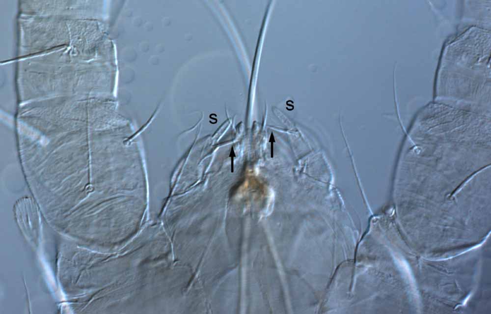 Fig. 6.  Raoiella davisi nbsp;adult female palp (s = solenidion; arrows indicate eupathidia). 
