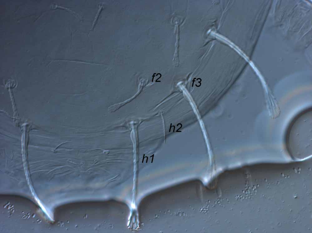  Fig. 2.  Raoiella davisi nbsp;adult female posterior dorsum. 
