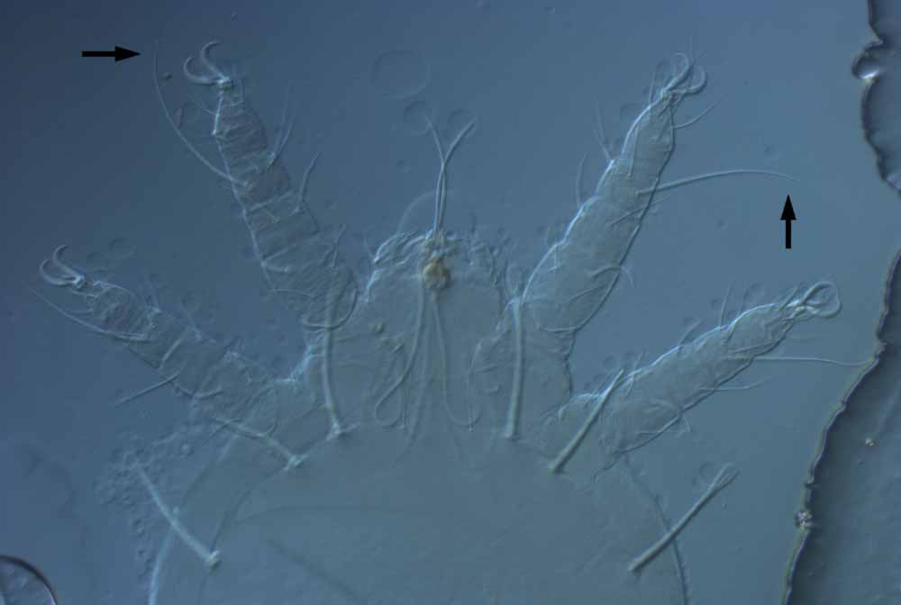  Fig. 5.  Raoiella davisi nbsp;adult female legs I-II (arrows = dorsal seta on tibia I). 
