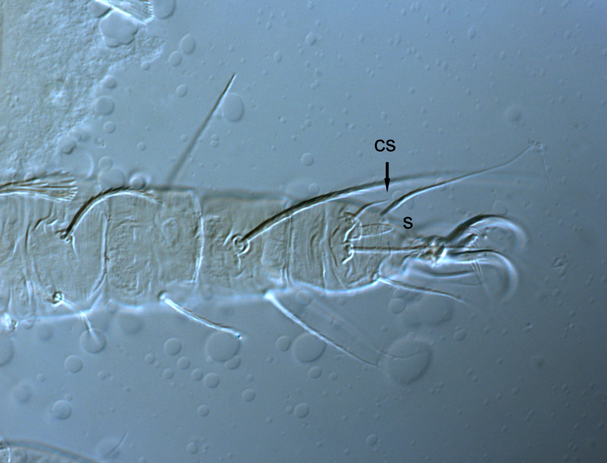  Fig. 4.  Raoiella davisi nbsp;adult female leg II (s = solenidion, cs = companion seta). 
