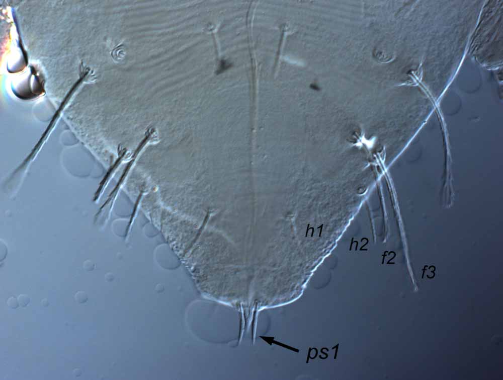  Fig. 8.  Raoiella davisi nbsp;adult male posterior opisthosoma, indicating  ps1  setae. 
