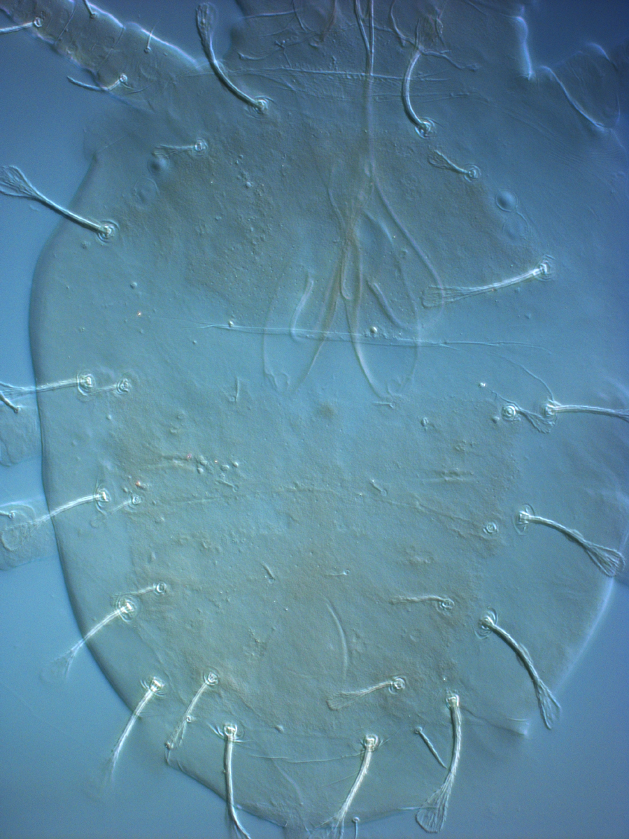            Fig. 2.   Raoiella australica  adult female   dorsum.   