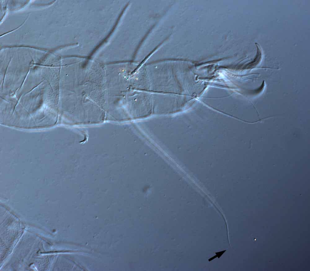  Fig. 5.  Raoiella didcota nbsp;adult female leg I (arrow indicates dorsal seta on tibia). 
