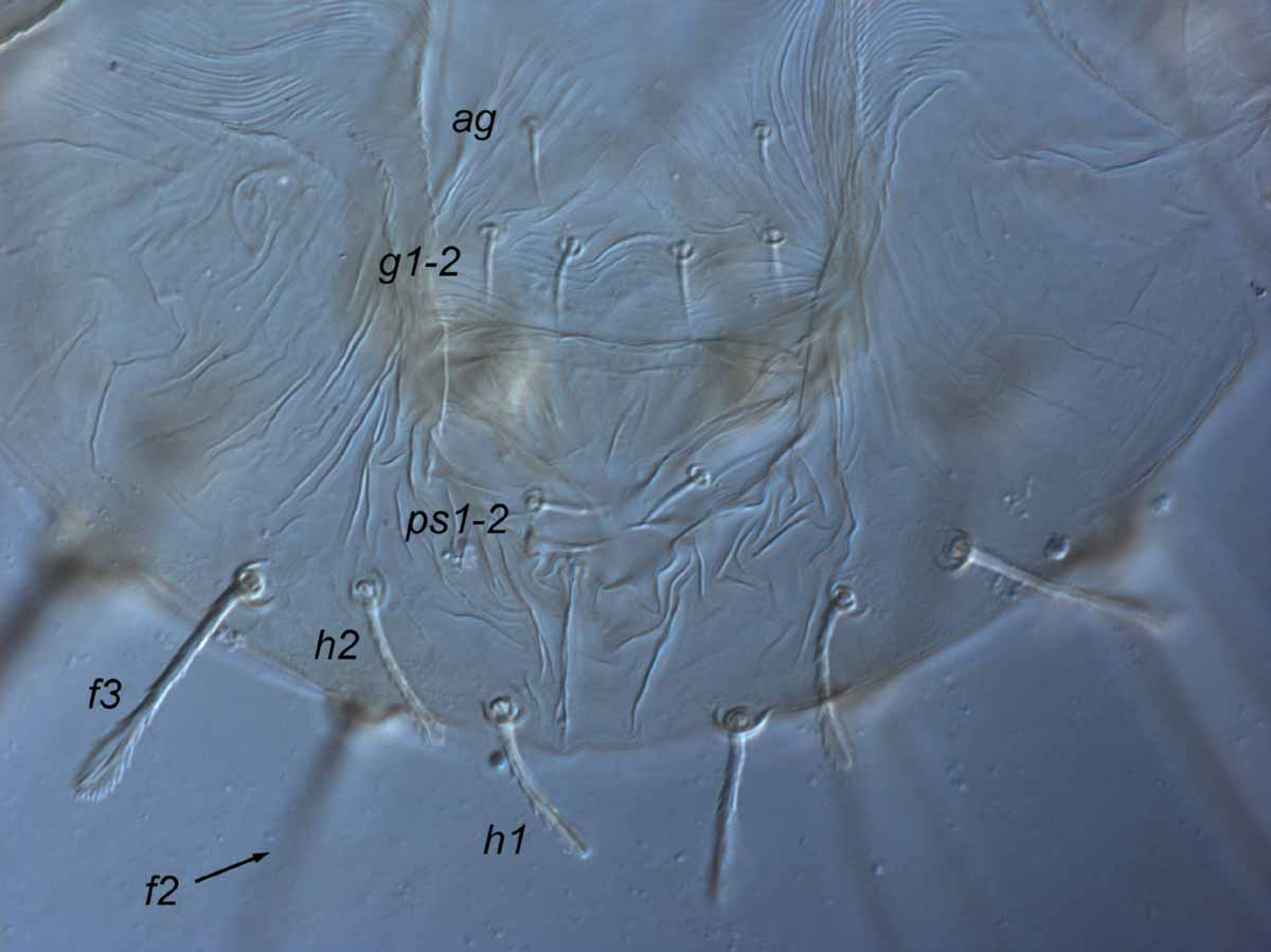            Fig. 3.   Raoiella eugeniae  adult female posterior venter   (genital region).   