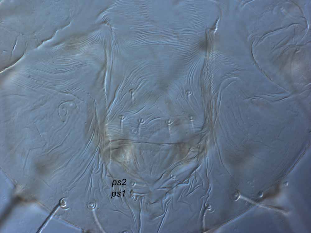            Fig. 8.   Raoiella eugeniae  adult female posterior venter   (genital region).   