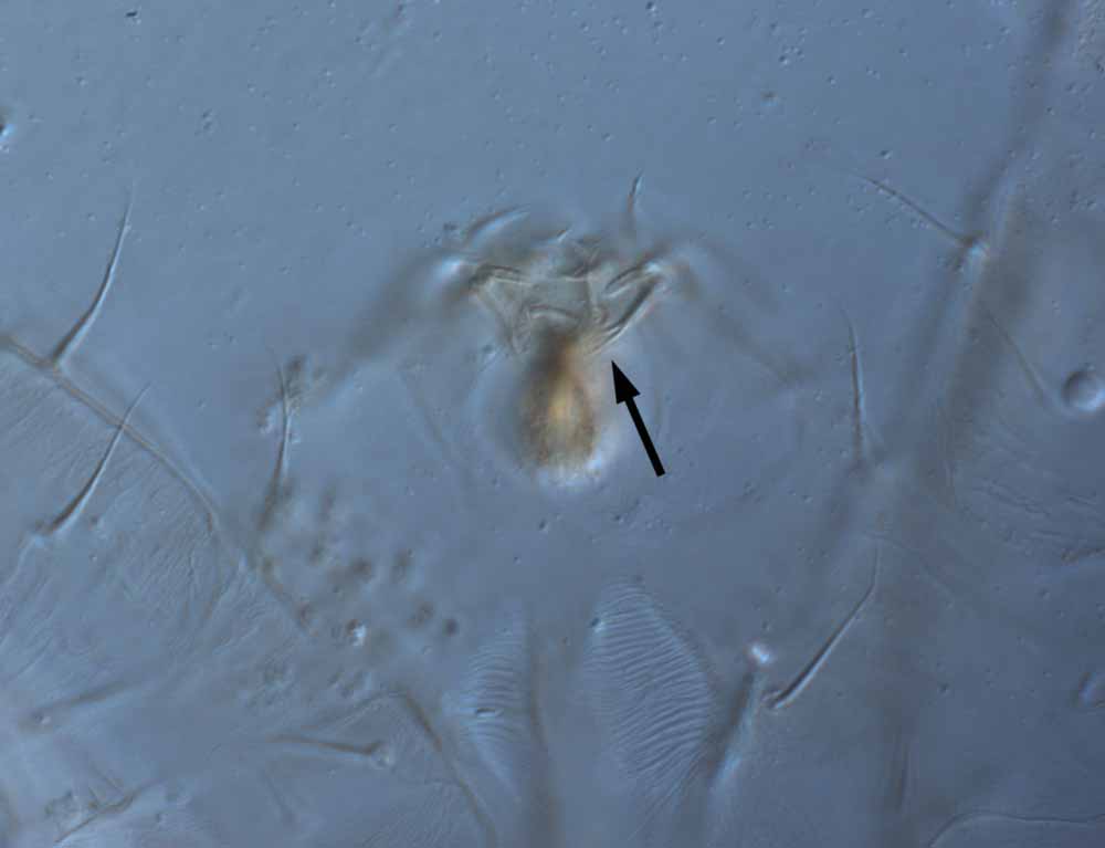            Fig. 7.   Raoiella eugeniae  adult female palp (arrow   indicates forked eupathidium).   