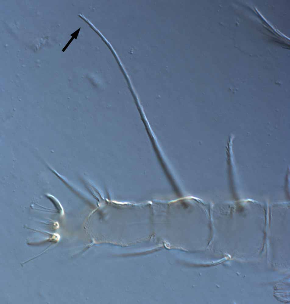            Fig. 6.   Raoiella eugeniae  adult female leg II (arrow   indicates dorsal seta on tibia).   