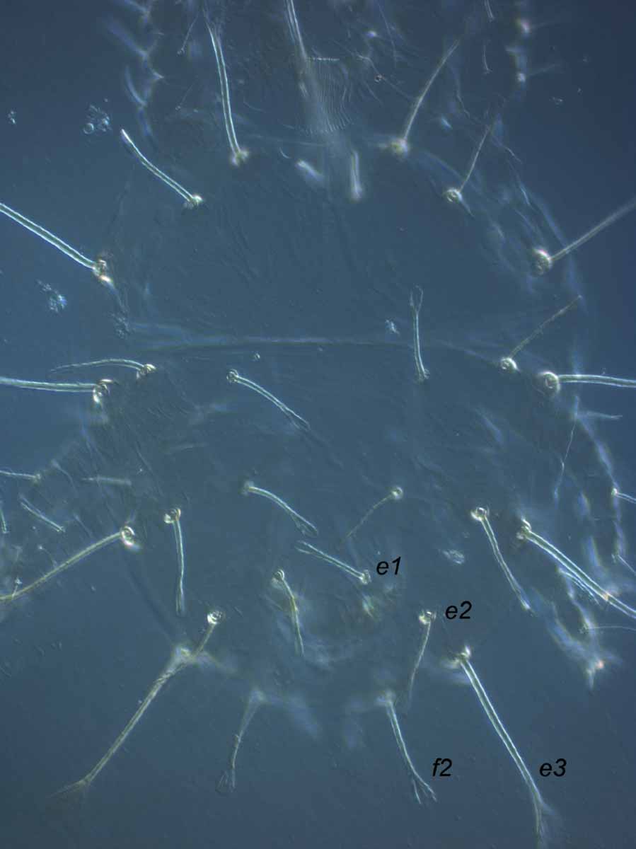            Fig. 2.   Raoiella eugeniae  adult female   dorsum.   