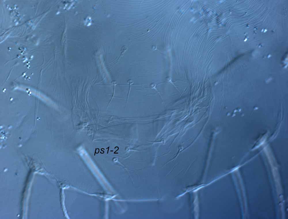  Fig. 8.  Raoiella hallingi nbsp;adult female posterior venter (genital region). 
