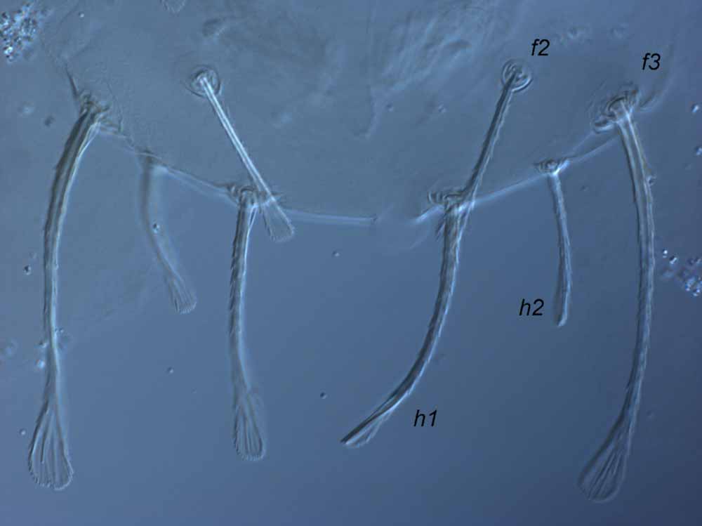  Fig. 3.  Raoiella hallingi nbsp;adult female posterior dorsum. 
