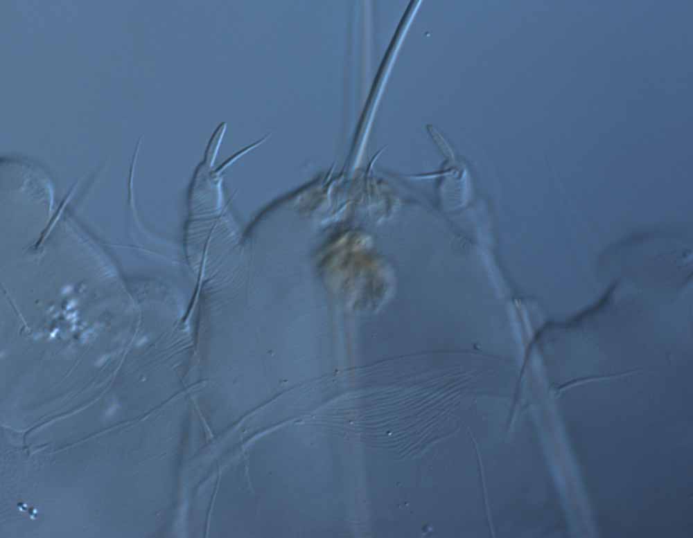  Fig. 7.  Raoiella hallingi nbsp;adult female palps (s = solenidion, e = eupathidium). 
