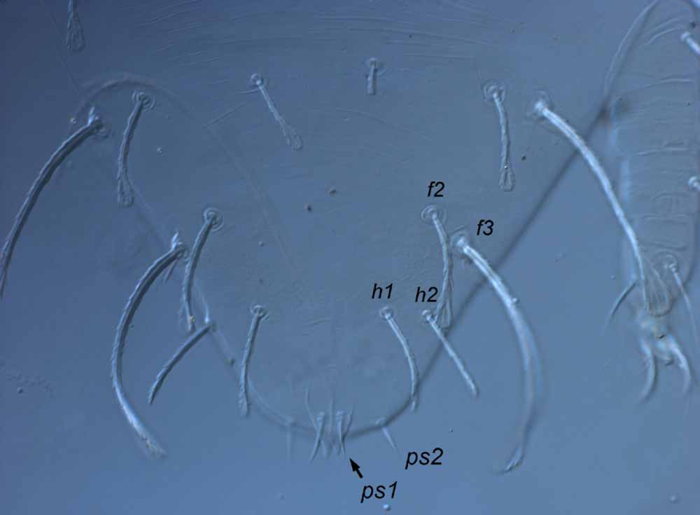  Fig. 8.  Raoiella hallingi nbsp;adult male posterior dorsum indicating short  ps1  setae. 
