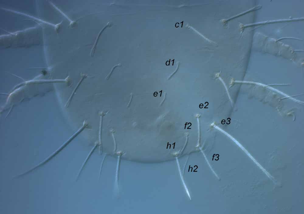            Fig. 6.   Raoiella indica  female posterior   dorsum.   