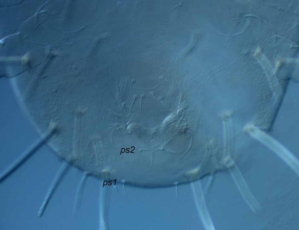            Fig. 12.   Raoiella indica  posterior   venter.   