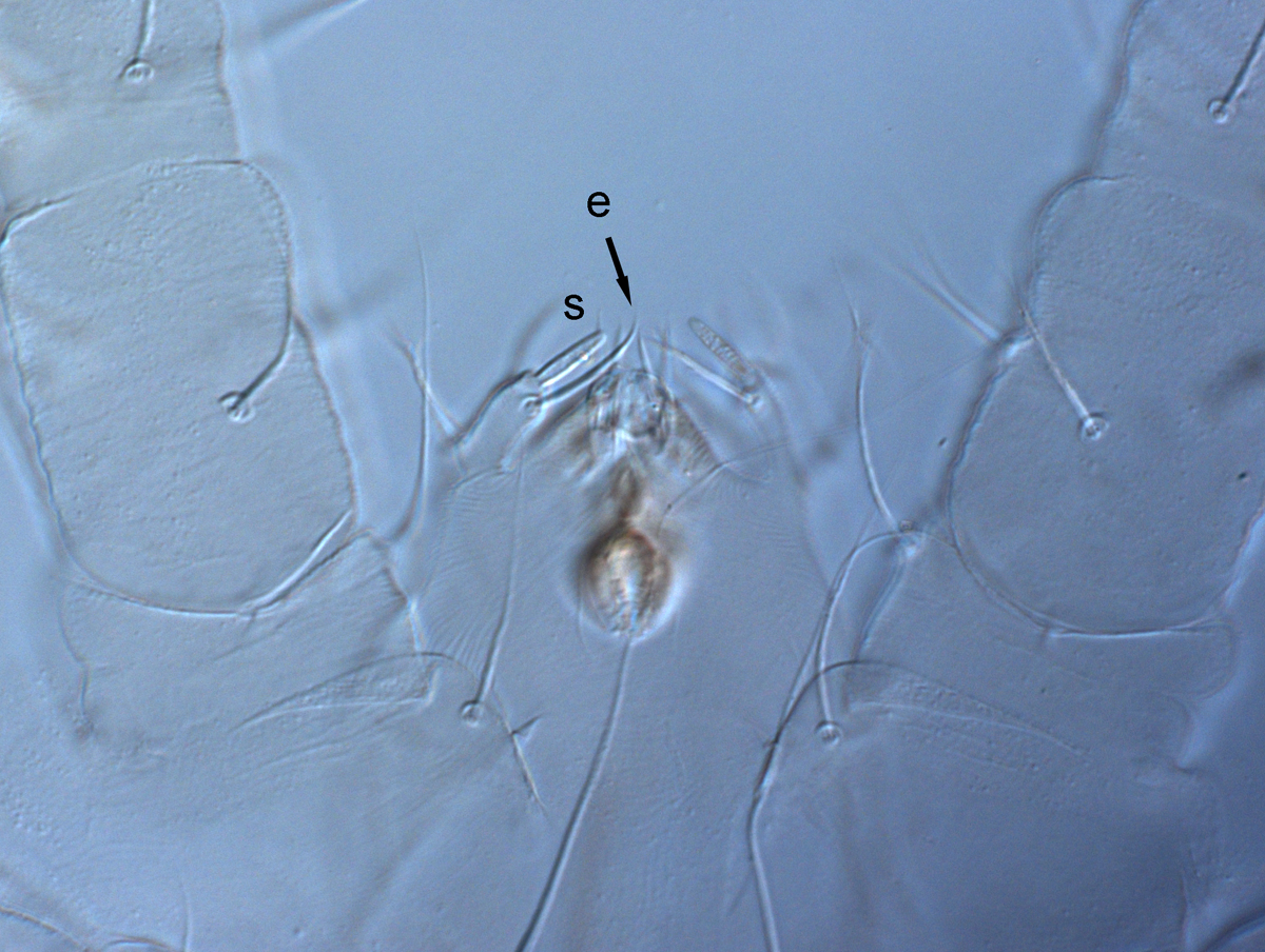            Fig. 11.   Raoiella indica  adult male palp (s =   solenidion; e = eupathidium).   