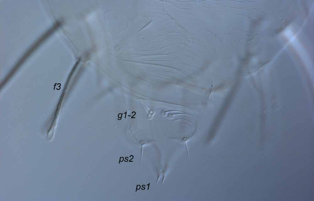            Fig. 14.   Raoiella indica  male posterior   venter.   